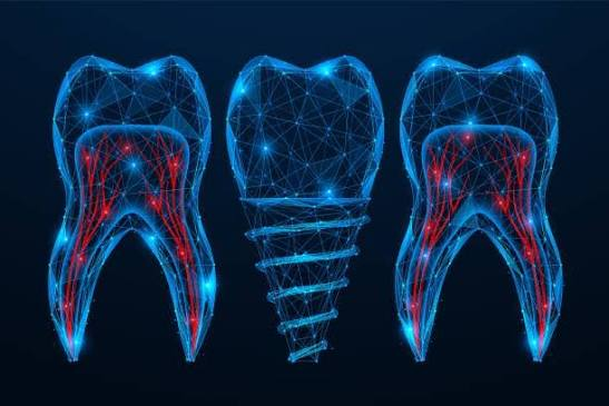 Digital dental implant and tooth imaging
